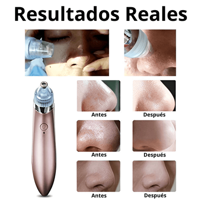 GlowPen Pro - Oiko Store